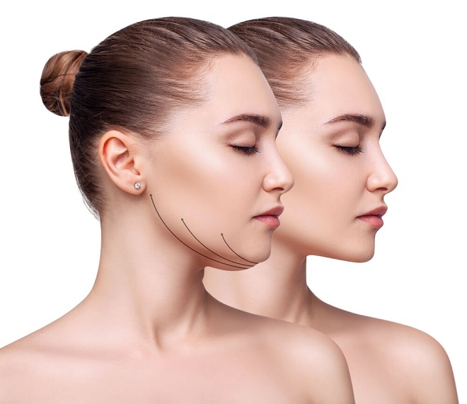Enhancing Facial Aesthetics: A Guide to Non-Surgical Jaw Slimming